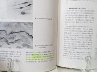 末梢神経損傷
