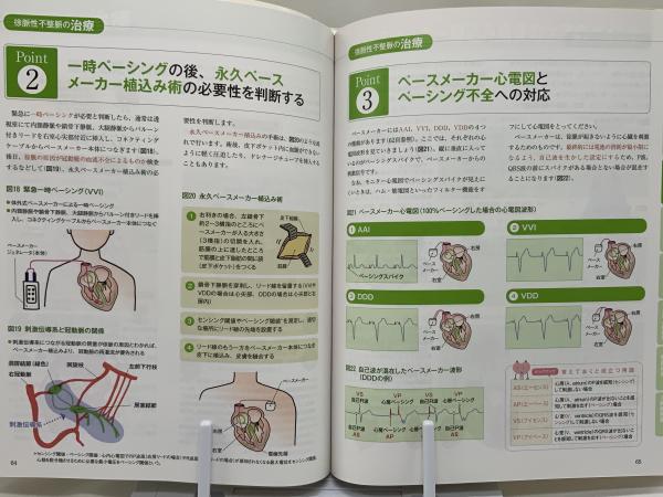 訳あり まるごと図解 循環器疾患 循環器疾患 本