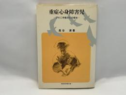 重症心身障害児 : びわこ学園からの報告