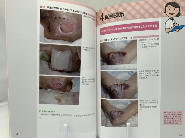 傷の正しい治し方　part1、2、3 3冊セット　水原章浩先生 と YNSA 傷の正しい治し方 part1、2、3 3冊セット 水原章浩先生 と YNSA