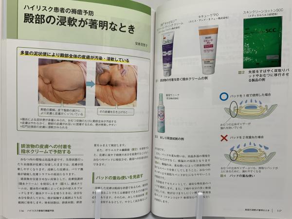 WOCナースの知恵袋 : 褥瘡・創傷・スキンケア(小林智美, 黒木さつき