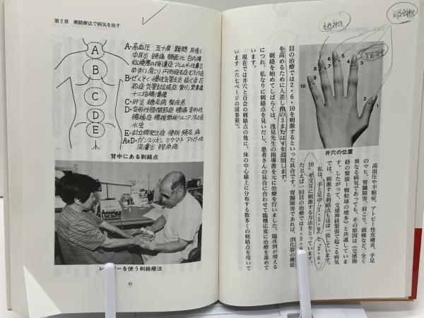 難病を治す驚異の刺絡療法 : リウマチ、アトピー性皮膚炎、C型