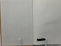 針灸治療の新研究