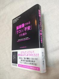 脳画像でみる「うつ」と「不安」の仕組み