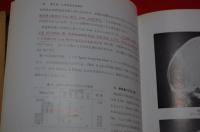 頭の写真 : 頭蓋単純撮影