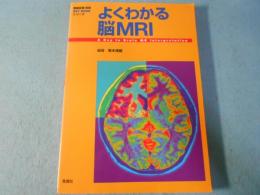よくわかる脳MRI