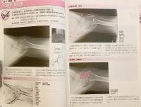 運動療法に役立つ単純X線像の読み方