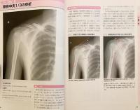 運動療法に役立つ単純X線像の読み方
