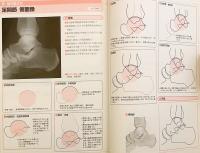 運動療法に役立つ単純X線像の読み方