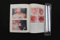 5　5　難病にいどむ奇跡の療法　昭和52年初版