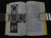 ６　２　神経内科治療ガイド　小川紀雄/編著　１９９１年　初版　