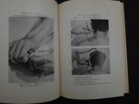 ８　5　刺絡法　工藤訓正　特殊刺法シリーズ　再版