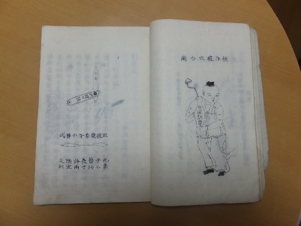 引痘畧(清 邱浩川) / 古本、中古本、古書籍の通販は「日本の