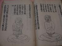 秘伝痘疹玉髄　 写本一冊