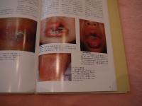 皮膚病変からわかる全身疾患