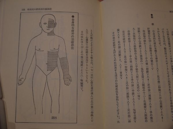 Amazon.co.jp: 平田式熱針刺激療法(オンデマンド版) : 間中 喜雄
