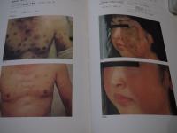 カラーグラフィック 皮膚病の漢方治療