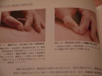 鍼灸医療安全ガイドライン
