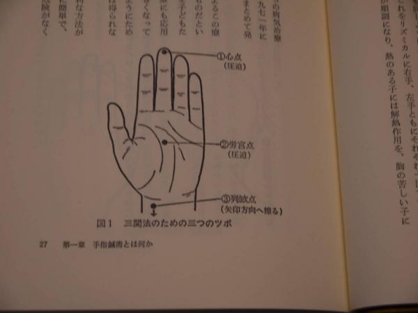 てのひらツボ療法 高麗手指鍼の原理と応用 １８７P(柳泰佑(著 ...