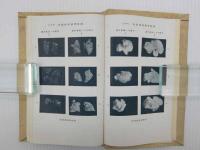 万病に効く お灸療法(原志免太郎) / 古本、中古本、古書籍の通販は