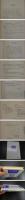 吸玉療法