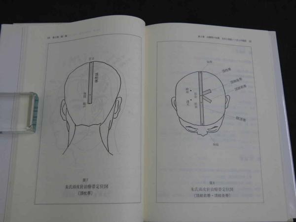 朱氏頭皮針 中古本・書籍 | ブックオフ公式オンラインストア