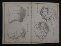 虞列伊氏解剖訓蒙図　啓蒙義舎蔵版　明治5年刻成　銅版全99図　2帖
