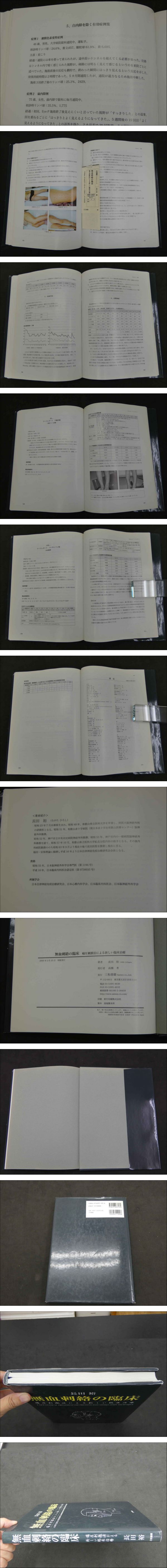 無血刺絡の臨床 痛圧刺激法による新しい臨床治療 (長田裕/著