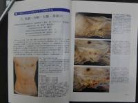 鍼灸OSAKA　vol.14　№2　通巻50号　［特集：顔面痛］