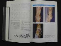 鍼灸OSAKA　通巻第68号　Vol.18.No.4／2002.Winter　特集:臨床シリーズ42　膝痛Ⅱ