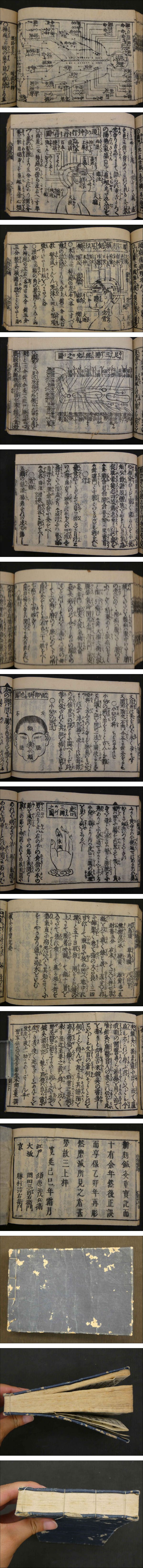 鍼灸重宝記綱目 本郷正豊 | ¥6,600 - 日本の古本屋 / 日本の古本屋