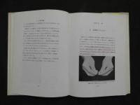灸頭針法　　