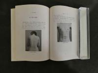 ３　灸頭針法