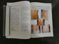 鍼灸OSAKA ３４　V0l.10 No.2/１９９４．Sum.