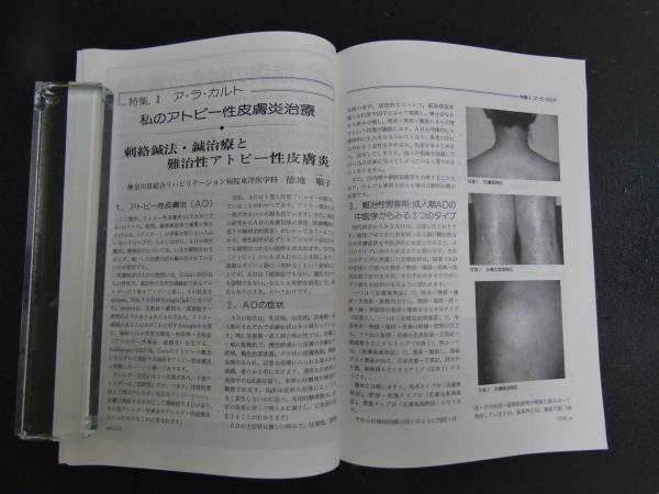 鍼灸医学臨床編 616p+0yLbwL.jpg