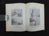 刺絡法　特殊針法シリーズ（英訳付）