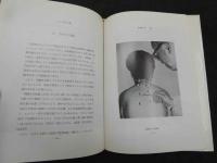 ６　②灸頭針法　