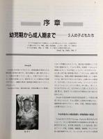 視覚機能の発達障害―その評価と援助