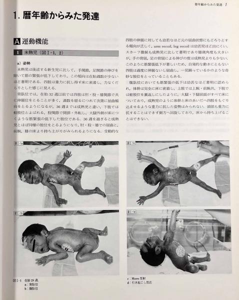 大割引 小児神経学アトラス(熊谷公明、大澤真木子、大矢達男、桜川宣男 医学一般