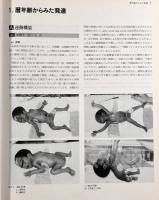 小児神経学アトラス