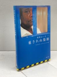 拷問はいま癒されぬ傷跡 現代人文社 アムネスティ インターナショナル