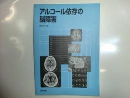 アルコール依存の脳障害