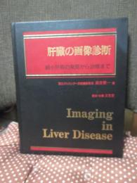肝臓の画像診断 : 細小肝癌の発見から治療まで