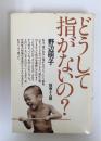 どうして指がないの?