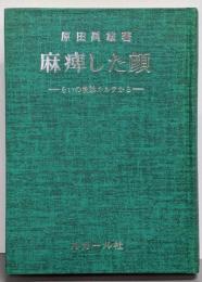 麻痹した顔 : らいの検診カルテから