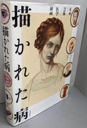 描かれた病:疾病および芸術としての医学挿画