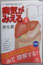 病気がみえる vol.1 消化器 第6版