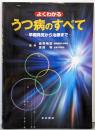 よくわかるうつ病のすべて: 早期発見から治療まで