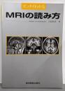 ゼッタイわかるMRIの読み方