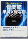 骨関節単純X線写真 はじめの一歩 (手にとるようにわかる)